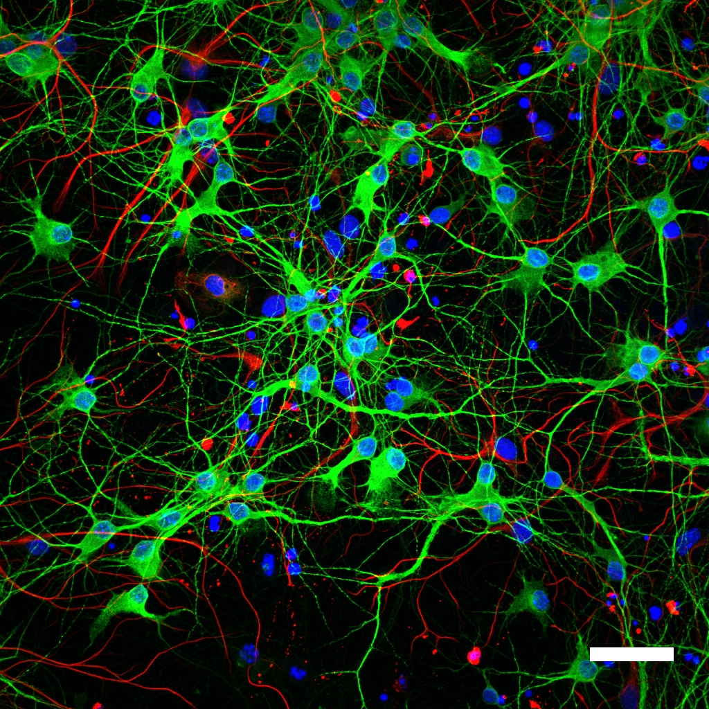 Primary Hippocampal Neuronal Cultures Spot On Micro